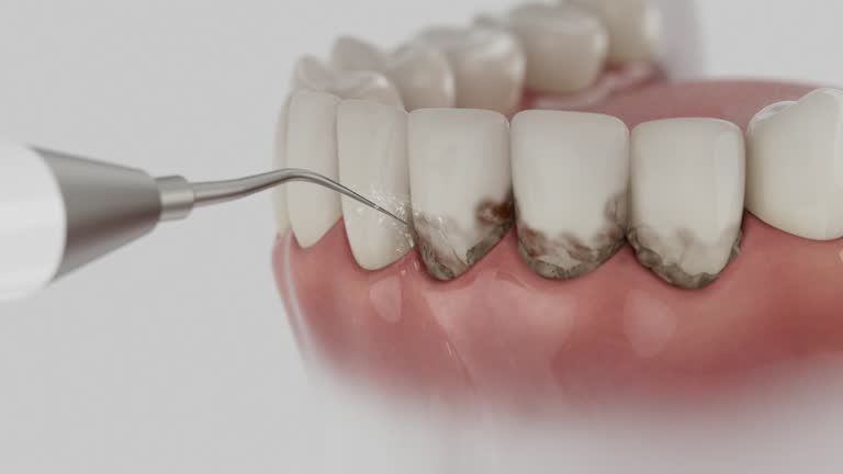 Reliable Dental Implants contractor in King Cove, AK by Smile Center Dentistry